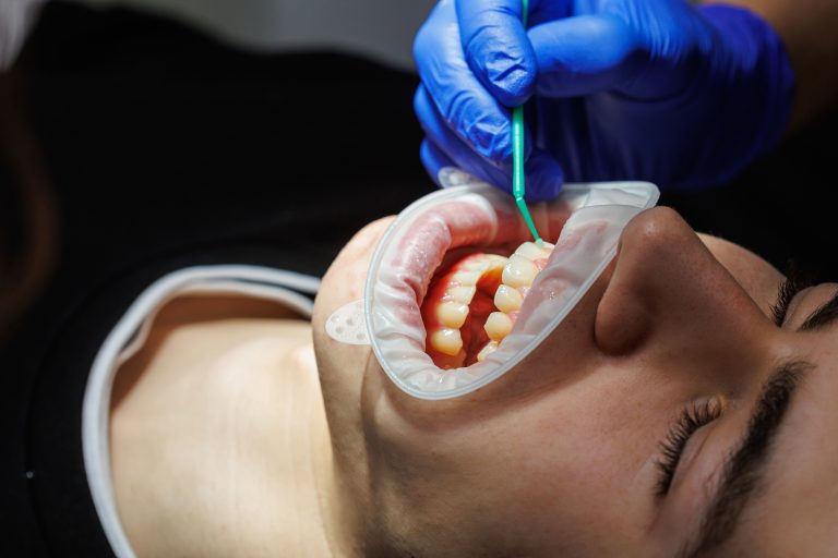 Close-up of teeth, dental checkup in the dental office. The dentist examines the patient's teeth with dental instruments. Dentistry. selective focus