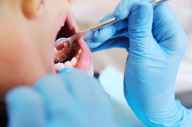 A cute, curly-haired child indulges and grimaces in a dental chair