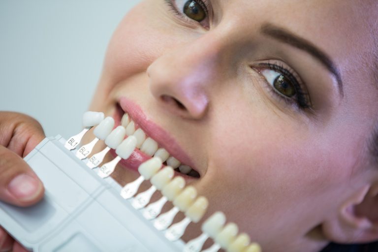 Dentist examining female patient with teeth shades at dental clinic