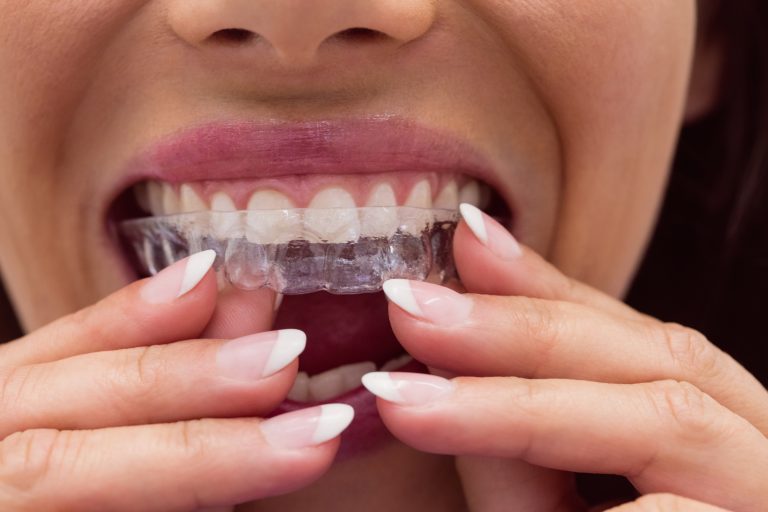 Close-up of female patient wearing braces in dental clinic