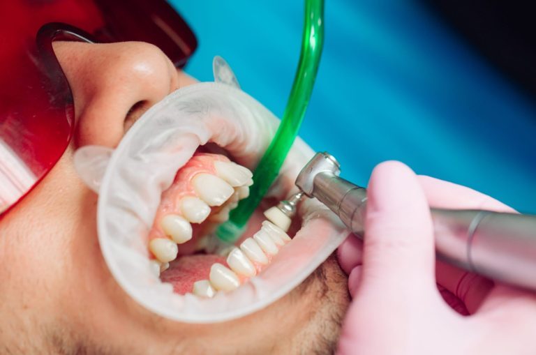 Professional teeth cleaning. Dentist cleans the teeth of a male