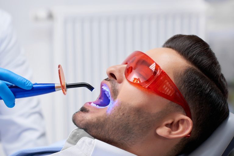 Profile close up shot of a handsome bearded man wearing protective glasses getting teeth filling done at his dental clinic copyspace technology ultraviolet UV lamp modern medicine health.