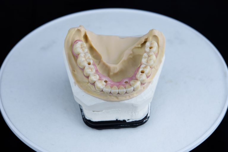 Teeth ceramics dentures on printed acrylic model in dental lab.