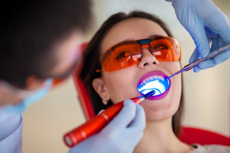 Treatment of light seal beautiful girl in dentistry.